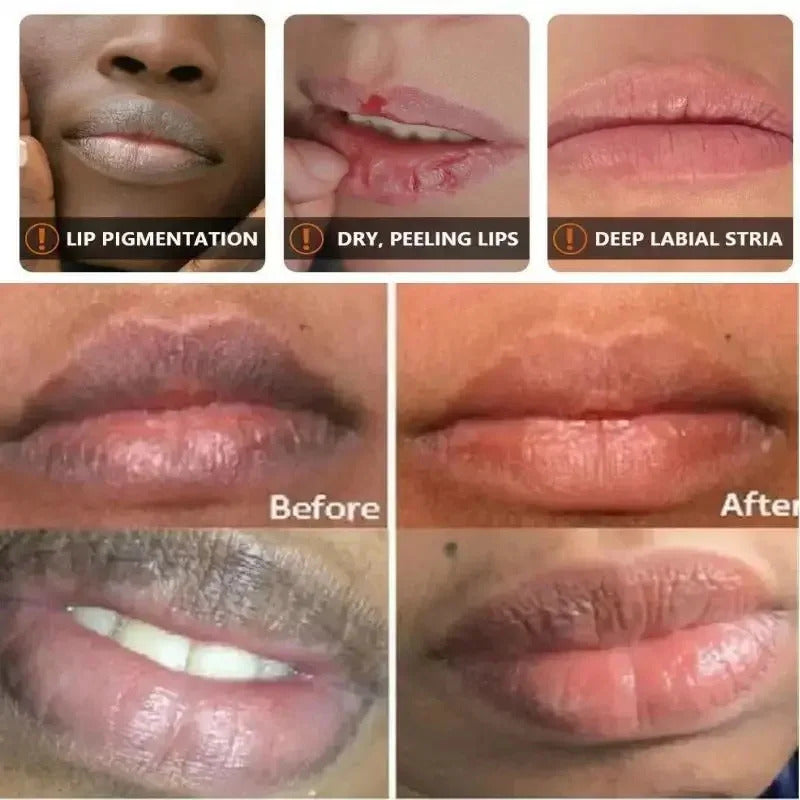 Dark Lip Balm & Lip Gloss ·Lighten Melanin, Exfoliating, Moisturizing, Korean Lip Care for Soft & Smooth Lips